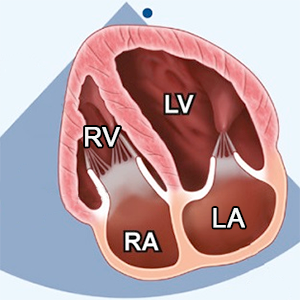 A4C (Apical 4 chamber) RV focused