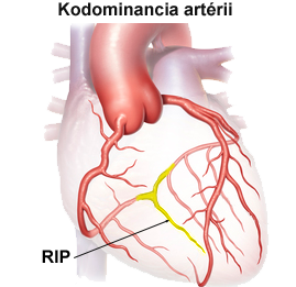 Codominant coronary artery heart