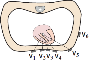 Wilson unipolar chest precordial leads (V1, V2, V3, V4, V5, V6)