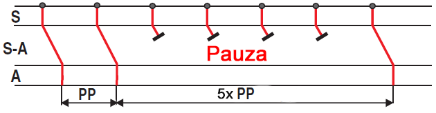Laddergram, sa node, sa junction, atria, 3rd degree sa block, pp pause