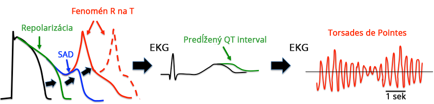 Action poteintial, prolonged QT interval, early afterdepolarization, premature ventricular beat - phenomenon R on T, Torsades de Pointes