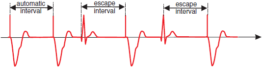 ECG pacemaker, automatic interval, escape interval